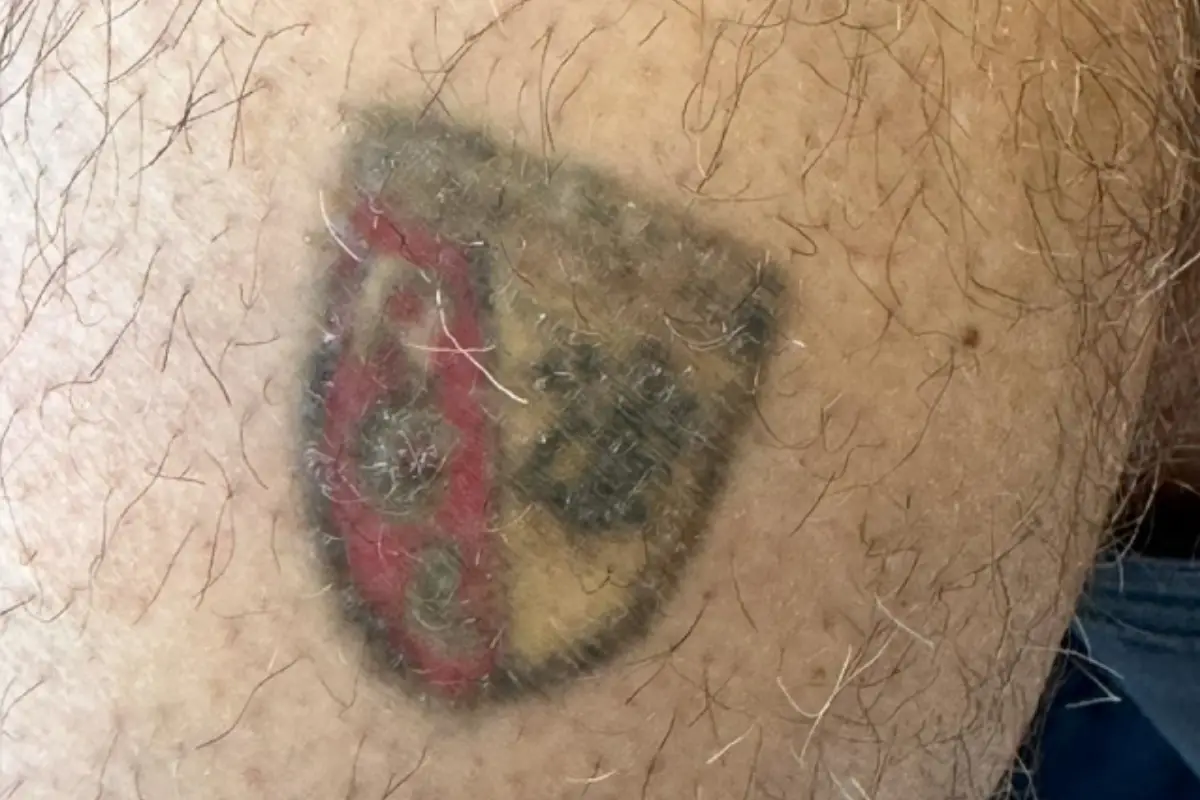 detatouage avant logo detatouage avant logo