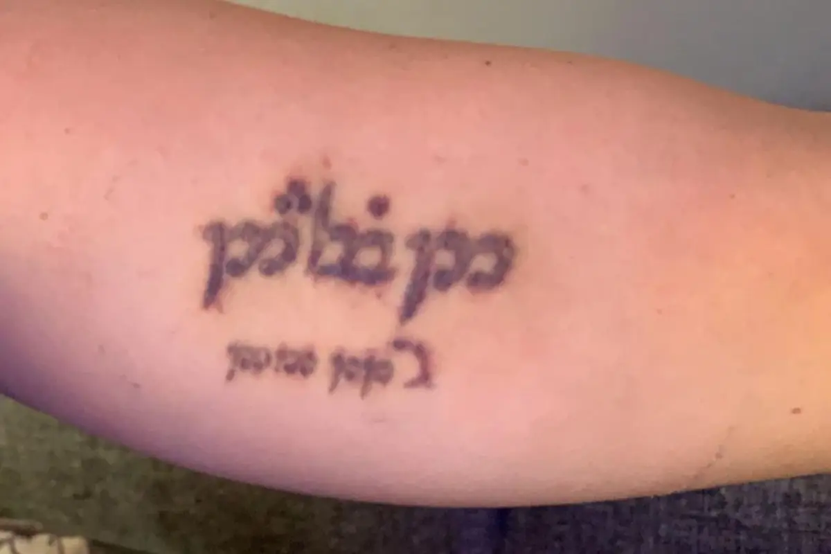 detatouage avant detatouage avant