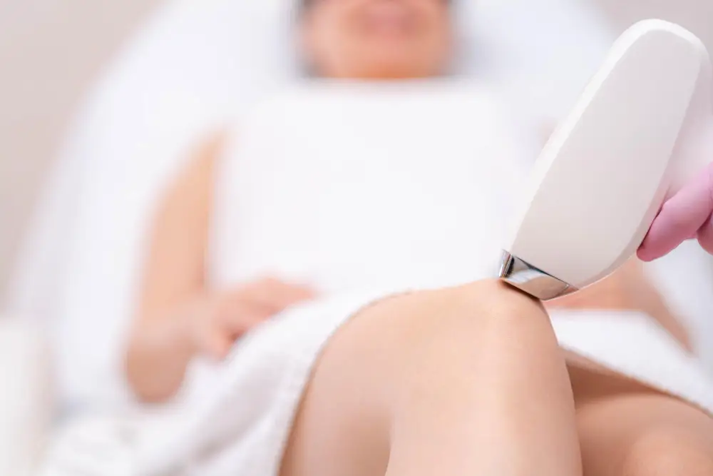 epilation laser quand et comment le faire en securite