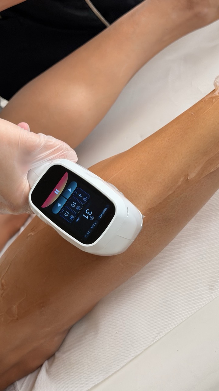 epilation laser jambes homme